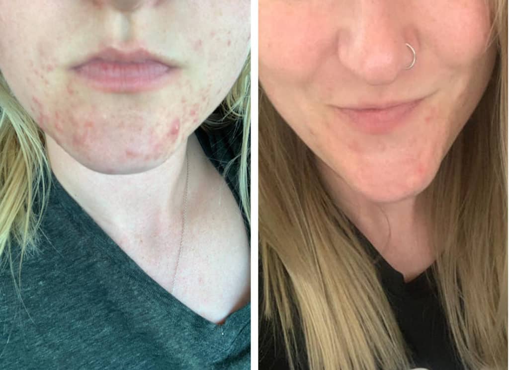 Before and After of using Beautycounter's Countertime collection.
